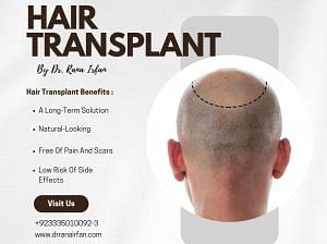 Hair transplant and hair fall treatment in islamab