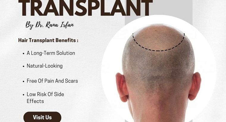 Hair transplant and hair fall treatment in islamab