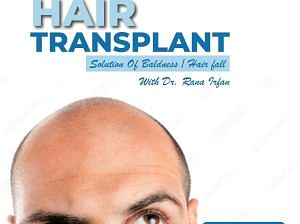 Hair transplant Services by dr rana Irfan at vagus