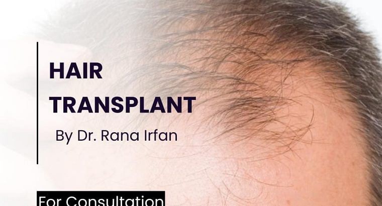 Best Hair transplant Services in Islamabad Pakista