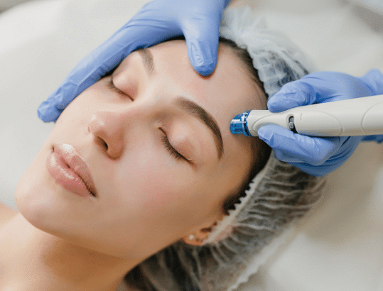 Best Skin Clinic in Jayanagar | Epiderma Clinic